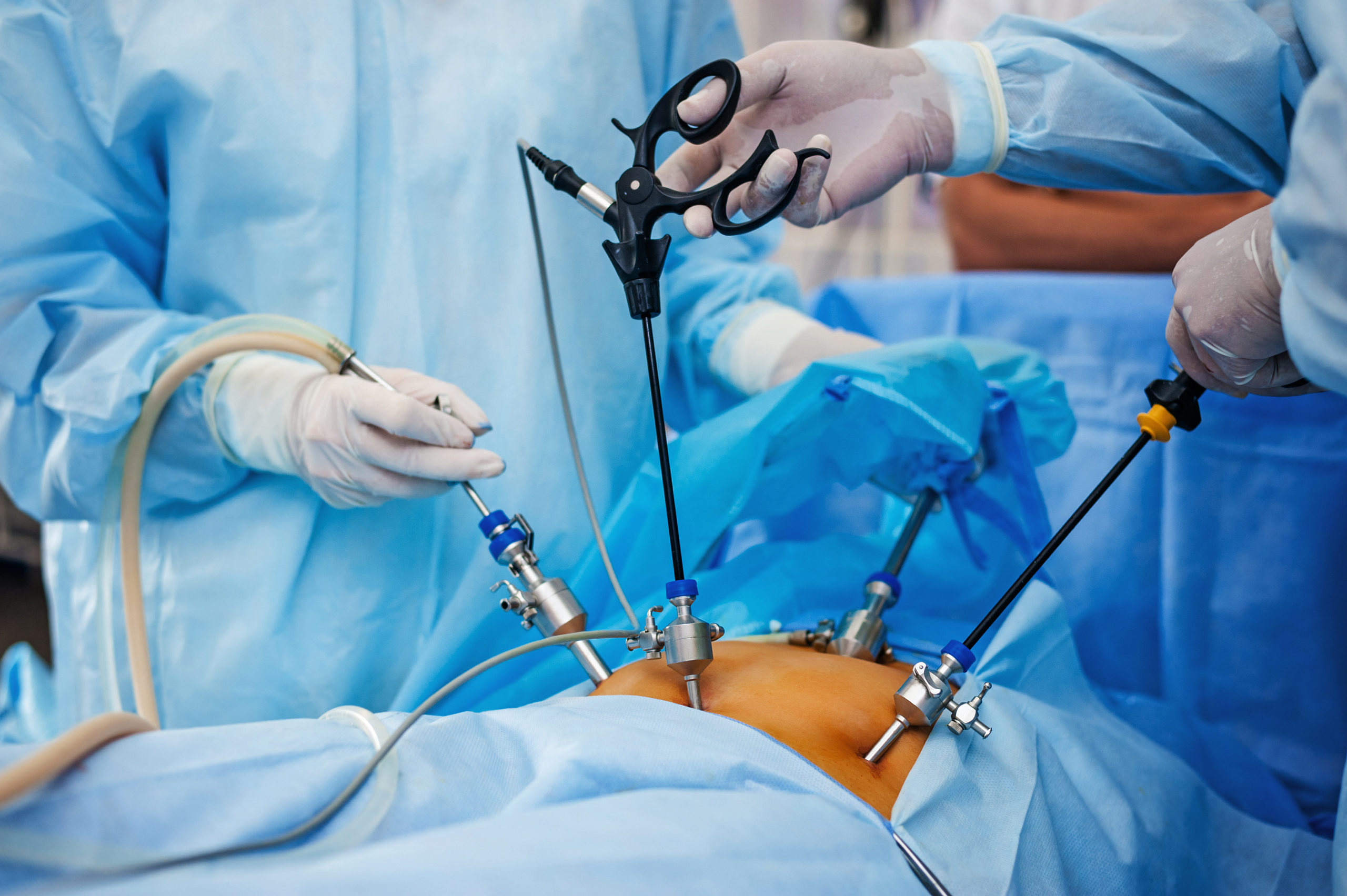 Advanced Fertility Laparoscopy
